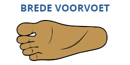 Brede voeten